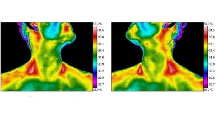 Thermography as a mom featured